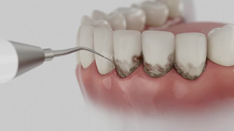 Reliable Dental Implants contractor in McLendon-Chisholm, TX by Smile Center Dentistry